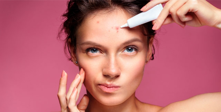 Cómo maquillarte cuando sufres acné