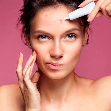 Cómo maquillarte cuando sufres acné